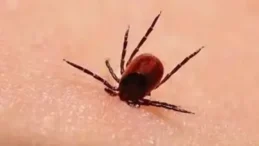 Uzmandan Kene Uyarısı! Çocuklarda Bu Belirtiler Görülüyorsa Zaman Kaybetmeyin