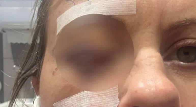 Kontakt lens nedeniyle gelişen göz enfeksiyonu
